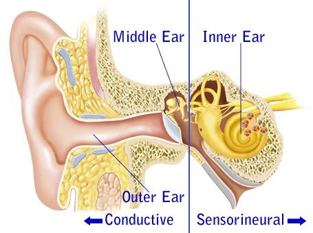 Conductive Hearing Loss: Symptoms, Causes