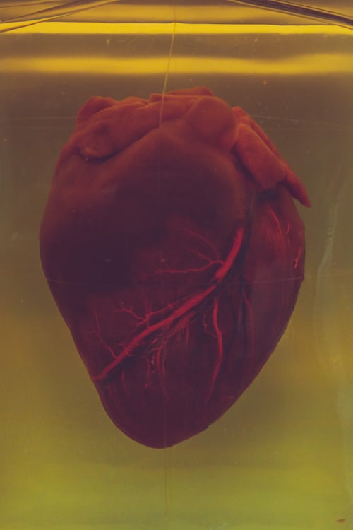 Heart Failure: A Comprehensive Guide