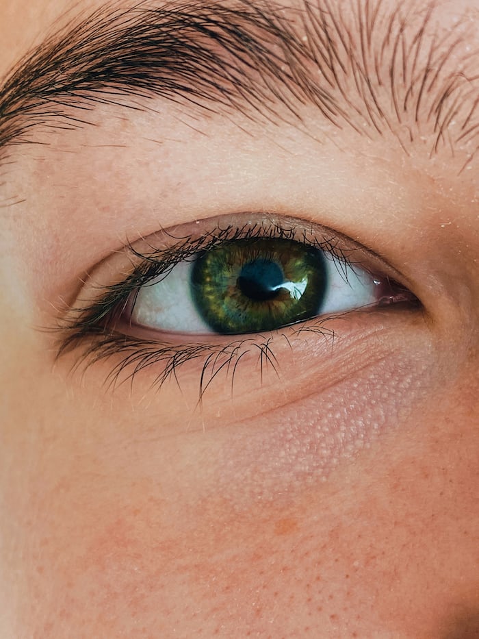 Floaters: What You Need to Know About This Common Eye Condition
