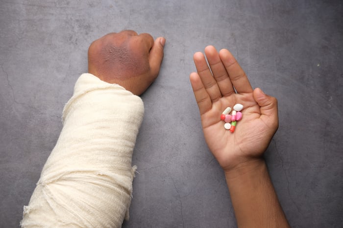 First aid to be given when a bone is broken in the hand